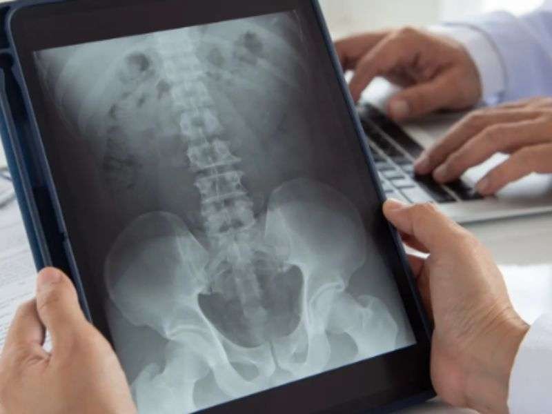 radiografia senza impegnativa