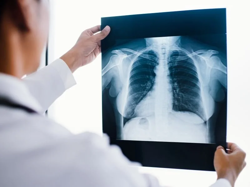 radiografie ai polmoni a domicilio