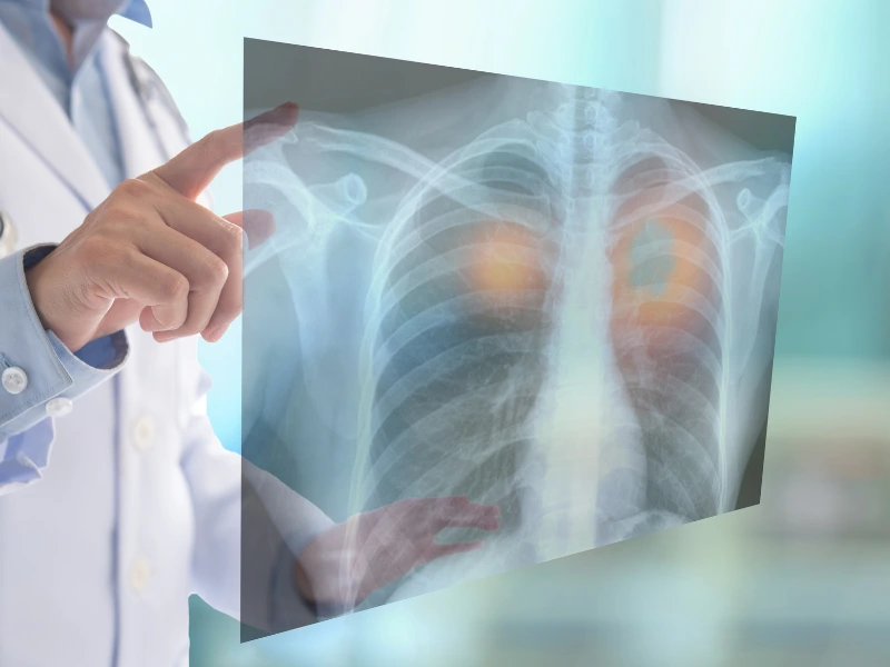 prenotazione radiografia milano