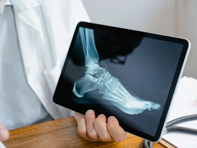 radiografia piede milano
