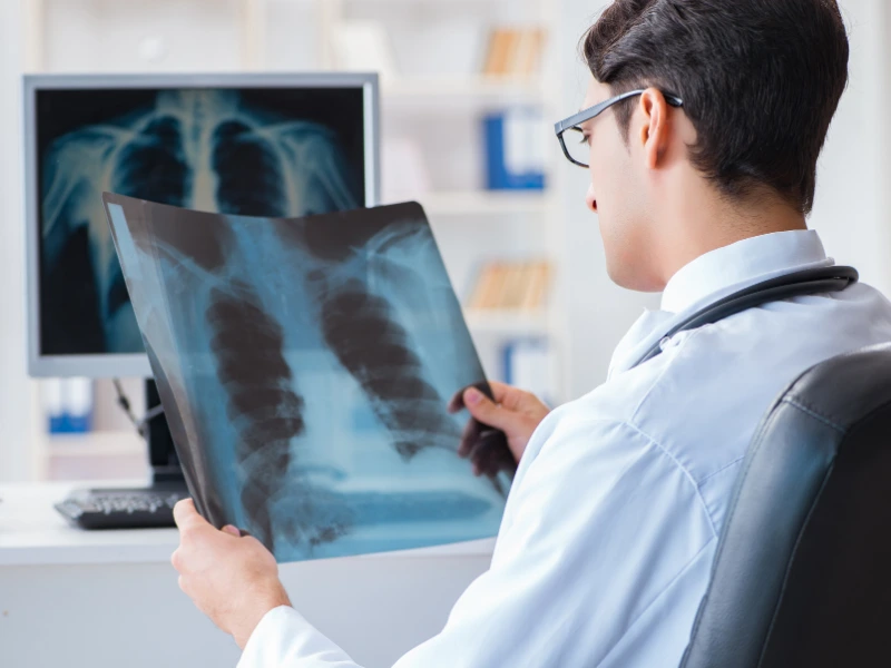 radiografia senza impegnativa milano