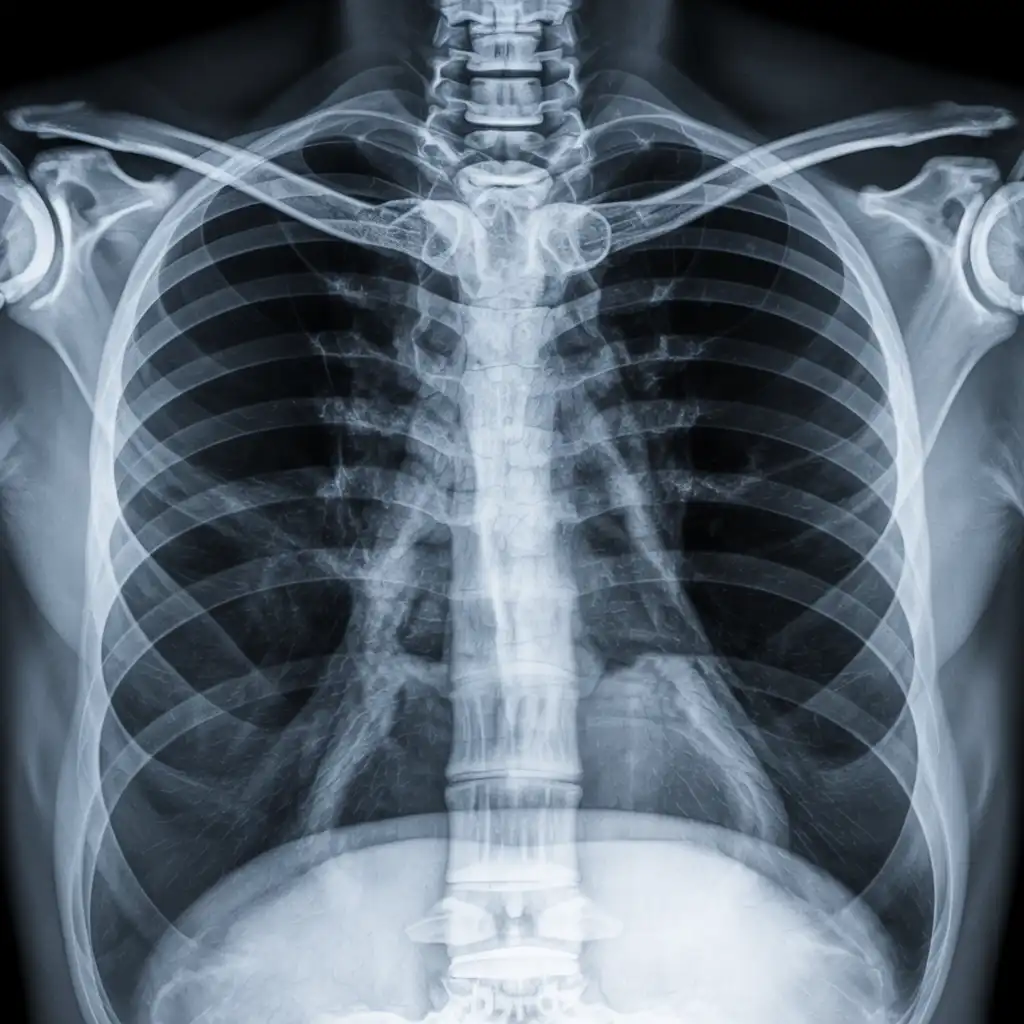 radiografia sterno